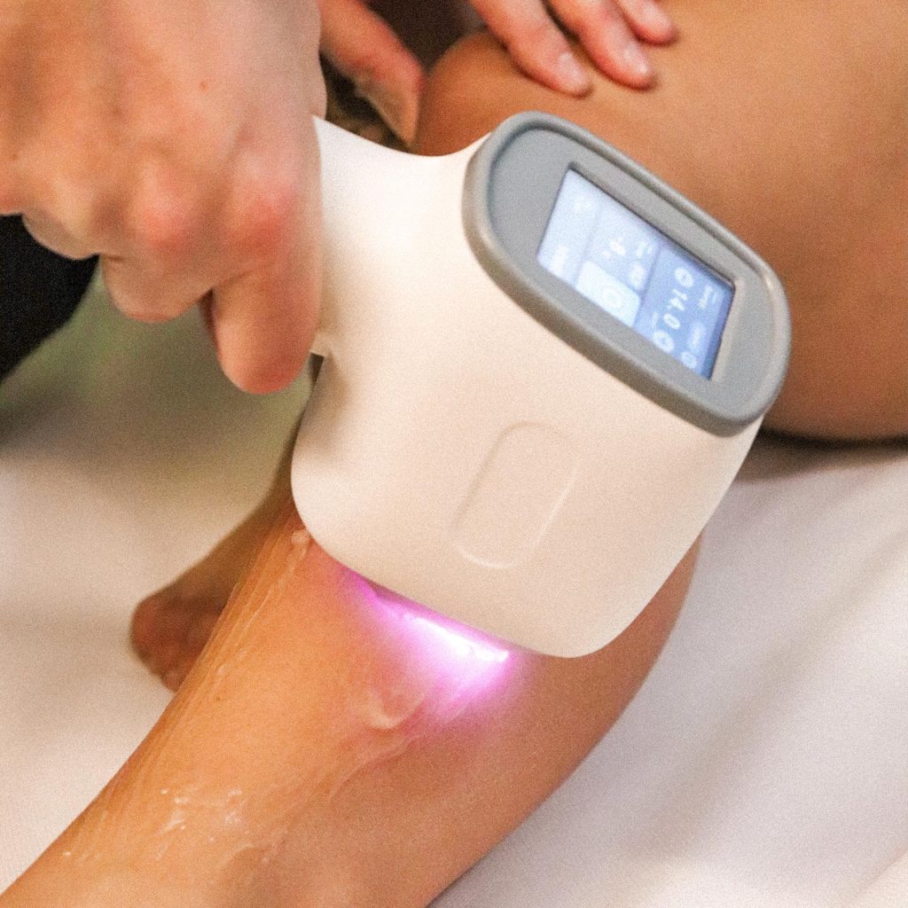 Epilazione laser corpo su gamba