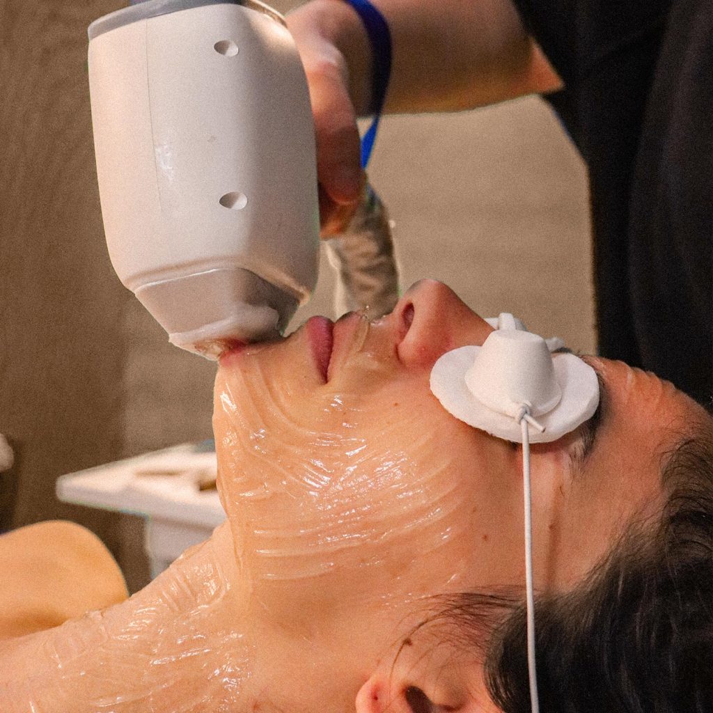 Con il laser avrai una pelle del viso liscia, libera dai peli e senza stress.